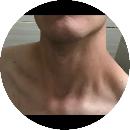 Bartu